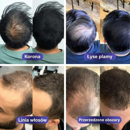 HairBloom™ Puder zagęszczający włosy