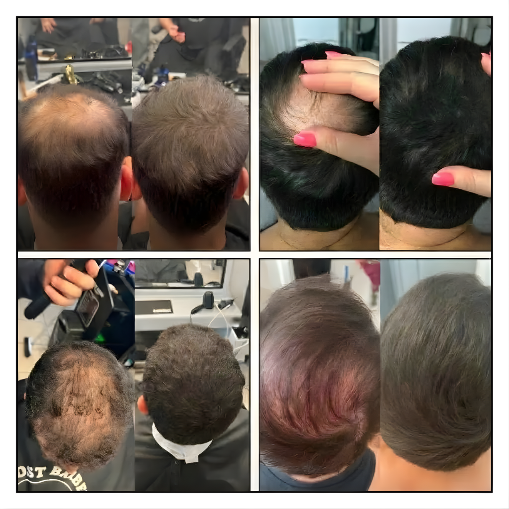 HairBloom™ Puder zagęszczający włosy